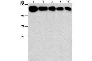 Western Blot analysis of A431, K562, 231, hela and hepG2 cell using HK2 Polyclonal Antibody at dilution of 1:1200 (Hexokinase 2 anticorps)