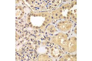 Immunohistochemistry of paraffin-embedded human kidney using ARNT2 antibody (ABIN5975251) at dilution of 1/100 (40x lens).