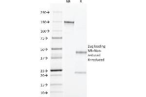 SDS-PAGE Analysis Purified TGF alpha Mouse Monoclonal Antibody (MF9). (TGFA anticorps  (C-Term))
