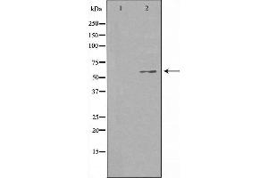 Western blot analysis of extracts from HuvEc cells using CCDC102B antibody. (CCDC102B anticorps  (Internal Region))