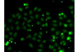 Immunofluorescence analysis of MCF-7 cells using NGFRAP1 antibody (ABIN5974398).