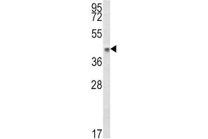 Western Blotting (WB) image for anti-Major Histocompatibility Complex, Class I, B (HLA-B) antibody (ABIN3003834) (HLA-B anticorps)