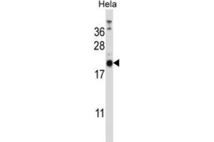 Western Blotting (WB) image for anti-Proline Rich Gla (G-Carboxyglutamic Acid) 1 (PRRG1) antibody (ABIN2997291) (PRRG1 anticorps)