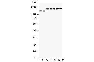 Western blot testing of DCC antibody and Lane 1:  rat brain