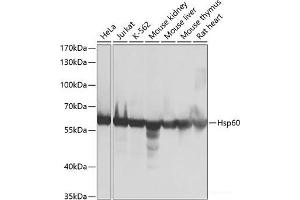 Western blot analysis of extracts of various cell lines using Hsp60 Polyclonal Antibody at dilution of 1:1000. (HSPD1 anticorps)
