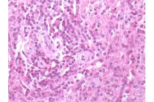 Human Spleen: Formalin-Fixed, Paraffin-Embedded (FFPE)