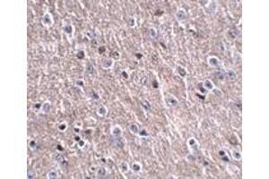 Immunohistochemistry (IHC) image for anti-LITAF-Like Protein (CDIP1) (Middle Region 1) antibody (ABIN1031187) (CDIP1 anticorps  (Middle Region 1))