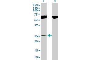 Western Blot analysis of RNF141 expression in transfected 293T cell line by RNF141 MaxPab polyclonal antibody. (RNF141 anticorps  (AA 1-230))