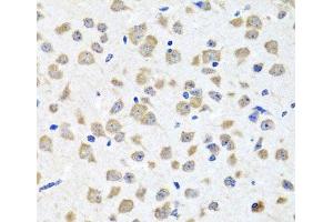 Immunohistochemistry of paraffin-embedded Mouse brain using PIP4K2B Polyclonal Antibody at dilution of 1:100 (40x lens).