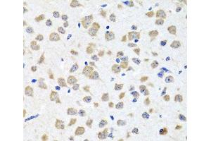Immunohistochemistry of paraffin-embedded Mouse brain using PIP4K2B Polyclonal Antibody at dilution of 1:100 (40x lens). (PIP4K2B anticorps)