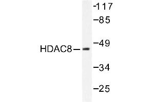 Image no. 1 for anti-Histone Deacetylase 8 (HDAC8) antibody (ABIN265460)