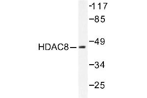 Image no. 1 for anti-Histone Deacetylase 8 (HDAC8) antibody (ABIN265460) (HDAC8 anticorps)