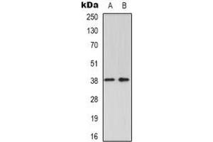 Western blot analysis of GRAP2 expression in K562 (A), Jurkat (B) whole cell lysates. (GRAP2 anticorps)
