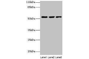 Western blot All lanes: CRNN antibody at 12 μg/mL Lane 1: HepG2 whole cell lysate Lane 2: Mouse heart tissue Lane 3: Rat skeletal muscle tissue Secondary Goat polyclonal to rabbit IgG at 1/10000 dilution Predicted band size: 54 kDa Observed band size: 54 kDa (CRNN anticorps  (AA 139-389))