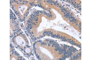 Immunohistochemistry (IHC) image for anti-Growth Differentiation Factor 11 (GDF11) antibody (ABIN2434352) (GDF11 anticorps)