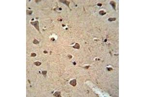 ALDH2 antibody immunohistochemistry analysis in formalin fixed and paraffin embedded human brain tissue. (ALDH2 anticorps)