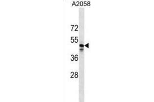 Western Blotting (WB) image for anti-MAS-Related GPR, Member F (Mrgprf) antibody (ABIN3000137) (Mrgprf anticorps)