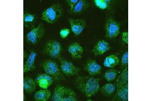 IF analysis of DGCR8 using anti-DGCR8 antibody (ABIN5692841). (DGCR8 anticorps  (AA 561-762))