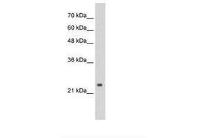Image no. 1 for anti-Cleavage and Polyadenylation Specific Factor 4, 30kDa (CPSF4) (C-Term) antibody (ABIN6736285)