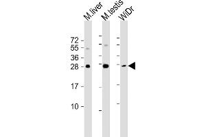 All lanes : Anti-CDX1 Antibody (C-term) at 1:1000-1:2000 dilution Lane 1: mouse liver lysate Lane 2: mouse testis lysate Lane 3: WiDr whole cell lysate Lysates/proteins at 20 μg per lane. (CDX1 anticorps)