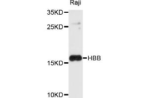 Western blot analysis of extracts of Raji cells, using HBB antibody (ABIN4903870) at 1:1000 dilution. (Hemoglobin Subunit beta anticorps)