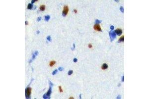 anti-serine/arginine-Rich Splicing Factor 5 (SRSF5) antibody