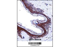SMARCE1 Antibody immunohistochemistry analysis in formalin fixed and paraffin embedded human skin tissue followed by peroxidase conjugation of the secondary antibody and DAB staining. (SMARCE1 anticorps  (C-Term))