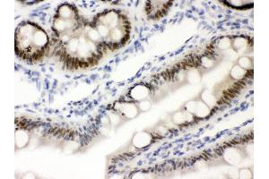 Anti-VDR Picoband antibody, IHC(P) IHC(P): Rat Intestine Tissue