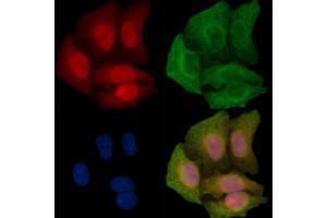 Phospho-MEKK1 (Thr1400) Antibody staining Hela cells(45 min of heat-shock treatment) by IF/ICC. (MAP3K1 anticorps  (pThr1400))