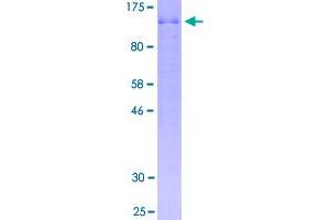 Image no. 1 for Breast Carcinoma Amplified Sequence 1 (BCAS1) (AA 1-584) protein (GST tag) (ABIN1346504)