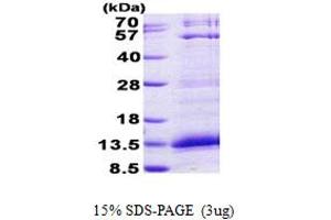 SDS-PAGE (SDS) image for Platelet Factor 4 (PF4) (AA 32-101) protein (His tag) (ABIN6387192)