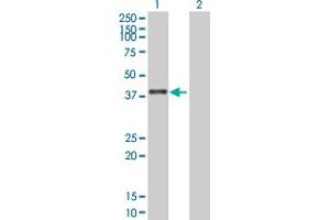 Western Blot analysis of ZNF783 expression in transfected 293T cell line by ZNF783 MaxPab polyclonal antibody. (ZNF783 anticorps  (AA 1-281))