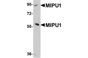 Western Blotting (WB) image for anti-Zinc Finger Protein 667 (ZNF667) (N-Term) antibody (ABIN1031458) (ZNF667 anticorps  (N-Term))