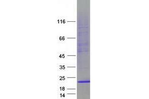Validation with Western Blot