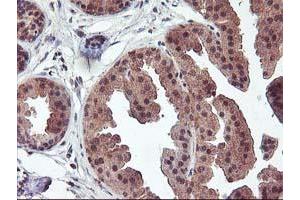 Immunohistochemical staining of paraffin-embedded Human breast tissue using anti-FGF21 mouse monoclonal antibody.
