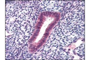 Human Uterus: Formalin-Fixed, Paraffin-Embedded (FFPE) (FOXN1 anticorps)