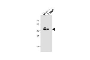 All lanes : Anti-LR6 Antibody (Center) at 1:1000 dilution Lane 1: Mouse heart tissue lysate Lane 2: Rat heart tissue lysate Lysates/proteins at 20 μg per lane. (LPAR6 anticorps  (AA 106-134))