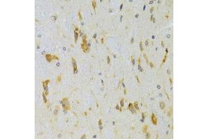 Immunohistochemistry of paraffin-embedded rat spinal cord using SCO2 Antibody. (SCO2 anticorps  (AA 1-130))