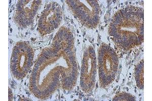 anti-Discoidin, CUB and LCCL Domain Containing 2 (DCBLD2) (AA 489-750) antibody