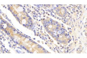 Detection of UBE2S in Human Small intestine Tissue using Polyclonal Antibody to Ubiquitin Conjugating Enzyme E2S (UBE2S)