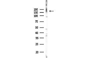 Western blot analysis of lysates from COLO205 cells(LPS,4h treatment), using CH Antibody at 1/1000 dilution.