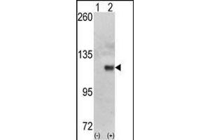 Western blot analysis of HK1 (arrow) using HK1 Antibody (N-term) (ABIN392759 and ABIN2842210).