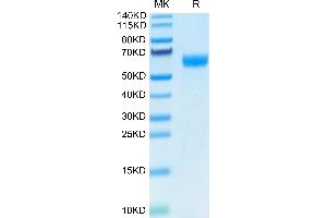 Human Ephrin B2 on Tris-Bis PAGE under reduced condition.