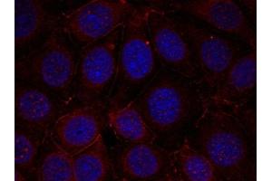 Immunofluorescence staining of methanol-fixed MCF cells using IGF-1R(Phospho-Tyr1165/Tyr1166) Antibody.