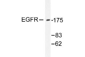 Image no. 1 for anti-Epidermal Growth Factor Receptor (EGFR) antibody (ABIN265395) (EGFR anticorps)