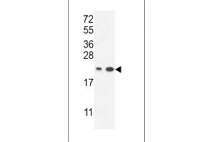 Western blot analysis in A2058,T47D cell line lysates (35ug/lane). (ABHD14B anticorps  (C-Term))