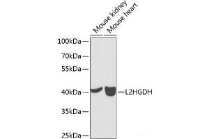 Western blot analysis of extracts of various cell lines using L2HGDH Polyclonal Antibody at dilution of 1:1000. (L2HGDH anticorps)