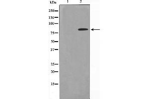Western blot analysis on HeLa cell lysate using ZNF225 Antibody,The lane on the left is treated with the antigen-specific peptide. (ZNF225 anticorps  (C-Term))