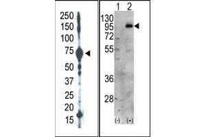 Image no. 1 for anti-Phosphatidylinositol-4-Phosphate 5-Kinase, Type I, gamma (PIP5K1C) (C-Term) antibody (ABIN360481) (PIP5K1C anticorps  (C-Term))