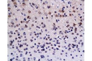 Formalin-fixed and paraffin embedded rat brain tissue labeled with Anti-Brdu Polyclonal Antibody , Unconjugated at 1:200, followed by conjugation to the secondary antibody and DAB staining